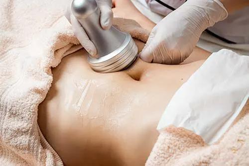 Abdominal Liposuction Surgery in Bangalo
