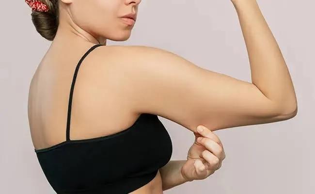 Arm Liposuction Surgery in Bangalore: Sc